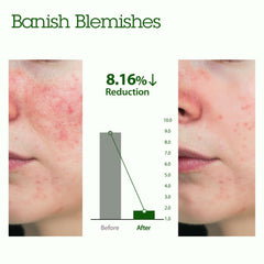 BLITHE Green Tea Exfoliant close-up showing gentle resurfacing