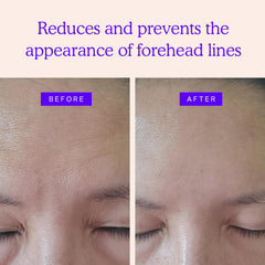 BLUMBODY patch application on forehead shows discreet, non-intrusive use