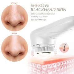 BONNIEFACE soft-bristle head close-up for gentle cleansing on sensitive skin