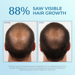 BosleyMD Minoxidil Spray 60-day supply supports fuller looking hair