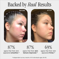 Brandefy No Needles serum label close-up highlights clean, fragrance-free formula for sensitive skin.