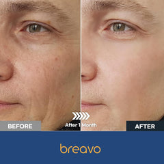 Breavo wrinkle-minimization scene illustrating smoother skin