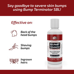 BREEJ Bump Terminator lotion on back-of-head area for soothing relief.