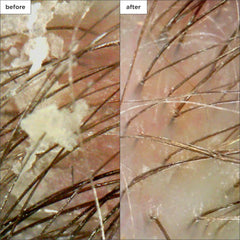 Briogeo Scalp Revival coconut oil swirl indicating deep scalp hydration