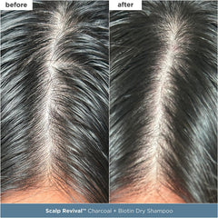 Briogeo Scalp Revival leave-in serum applying for lightweight hydration