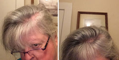Caboki before-after look illustrates fuller appearance with fibers