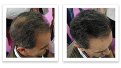 Salt & Pepper-Dark shade from Caboki blends with gray hair.