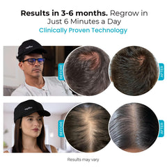 Capillus Spectrum side view shows wearable cap design for daily use.