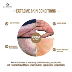 CARAWAY Bakuchi Oil droplets on hand, suggesting easy blending with carrier oils.