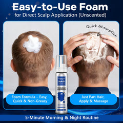 CARENICE Minoxidil Foam for beard application, discreet daily use.