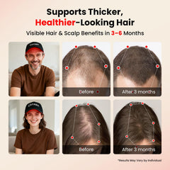CAYAMA cap highlights crown area therapy for balanced scalp treatment