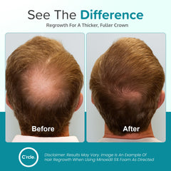 C'rcle Minoxidil Foam 5% unscented foam applied to scalp