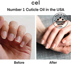 Cel MD Damaged Nails Before After highlights improvement with care.