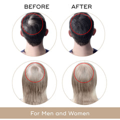 Close-up of Charismo Dekohair label highlighting natural formula and benefits.