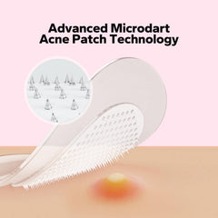 CharmCherry hydrocolloid patch on skin demonstrates discreet blemish protection.
