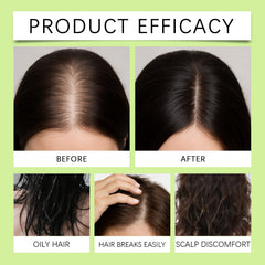 ChLNDalin Alpha Infuse serum drops enable precise scalp treatment at home