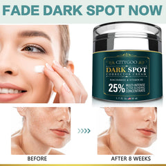 CityGOO Dark Spot Remover cream tube ready for targeted blemish correction.