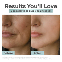 Clear Essence sulfur-infused antifungal bar shown for pores