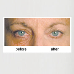Clientele peptide wrinkle concealer compact neutral texture close-up for natural finish.