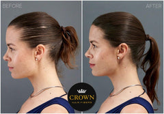 CROWN TWENTY1 weather-resistant fibers stay in place through wind and sweat