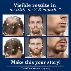 DAAZZS minoxidil biotin niacinamide closeup highlighting nourishing support