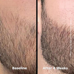 DABALASH serum drops on skin showing quick absorption