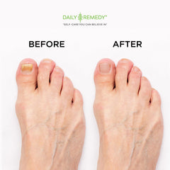 Daily Remedy Ingredients sea salt blend showcases natural power for soothing feet.