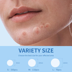 Daolyo Pimple Patches 12mm provides larger patch for bigger zits.