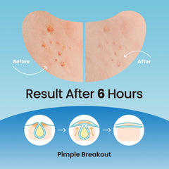DERMA ANGEL XL patches on the forehead close-up highlight a barely-there finish.