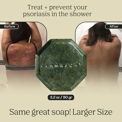 Dermabon deep moisturizing formula leaves skin soft after cleansing.