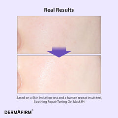 Dermafirm R4 hydrogel texture close-up shows cooling relief.