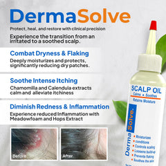 Dermasolve scalp oil pour demonstrates easy application for daily care and comfort