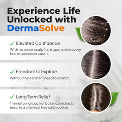 Dermasolve scalp close-up shows relief from itching during use.