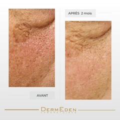 DERMEDEN Night Protocol Eye Cream box for premium gifting and display