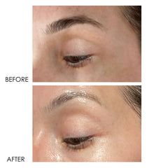 Dermelect Revitalite eye cream texture indicating rich hydration for the eye area.