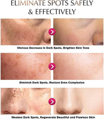 Deuiosna Snow Bleach Cream elbows image for smoothness and moisture