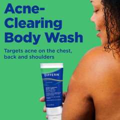 Differin acne body wash lather in hand for back and shoulders.