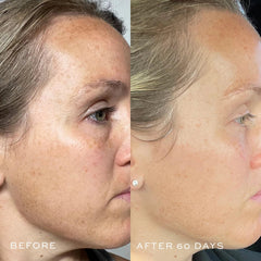 DIME Beauty TBT Serum ingredients panel showing mandelic acid and bakuchiol.