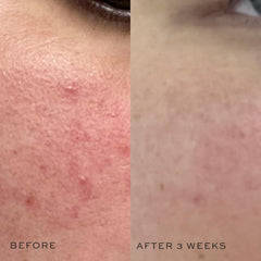 DIME Super Skin Toner applied with cotton pad to refresh the face.