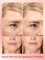 Divmceknyy base gel bottle supports improved RF energy delivery during treatments.