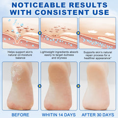 DLOMFVFQ All-skin-types stick smooths rough patches safely.