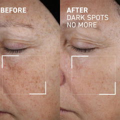 Dr. Brandt Bright This Way tip applying gel directly to pigmentation