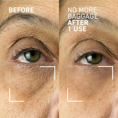 Dr. Brandt Needles No More Baggage travel-size bottle for on-the-go eye refresh