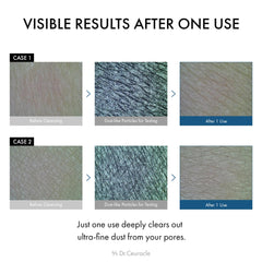 Close-up of enzyme powder transforming into gentle foam for cleansing.