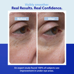 Peptides and ceramides reinforce the eye area’s resilience