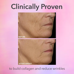 Dr Dennis Gross FaceWare Pro worn on the face showing hands‑free treatment for refreshed look