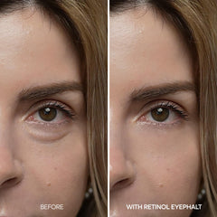 Dr.Melaxin eyebag cream label highlights niacinamide and ceramide ingredients.