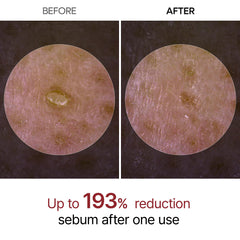 Dr.Melaxin Peel Shot Glow Niacinamide ingredient close-up shows brightness potential