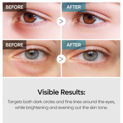 Dual formulation of Dr.Melaxin TX Tranexamic Eye Cream on display