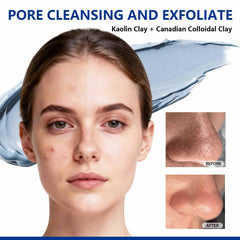 Applying Dr Vincent Blue Clay Mask on the face for smoother skin